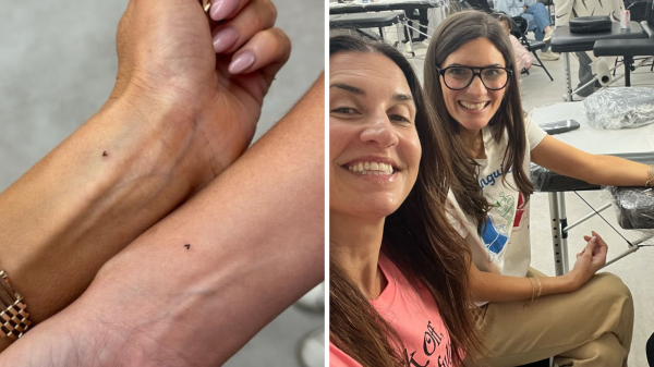 Why My Micro Fine-Line Tattoo Fell Off a Week After I Got It